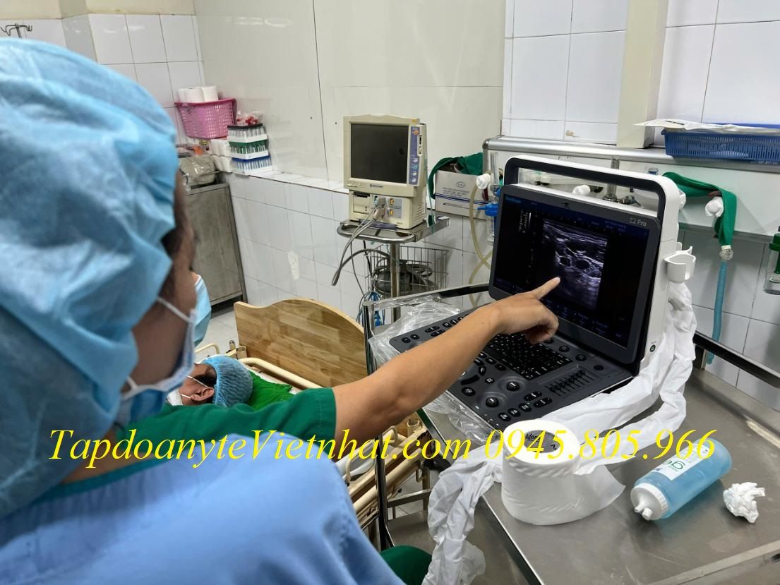 Máy siêu âm cơ xương khớp